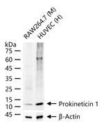 PROK1 Recombinant Rabbit Monoclonal Antibody (2A8)