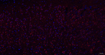 gamma Adaptin Antibody in Immunohistochemistry (Paraffin) (IHC (P))
