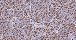 gamma Adaptin Antibody in Immunohistochemistry (Paraffin) (IHC (P))