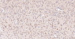 gamma Adaptin Antibody in Immunohistochemistry (Paraffin) (IHC (P))
