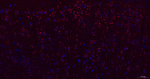 gamma Adaptin Antibody in Immunohistochemistry (Paraffin) (IHC (P))