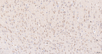 gamma Adaptin Antibody in Immunohistochemistry (Paraffin) (IHC (P))