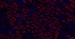 gamma Adaptin Recombinant Rabbit Monoclonal Antibody (3G12)