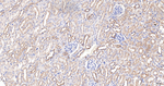 gamma Adaptin Antibody in Immunohistochemistry (Paraffin) (IHC (P))