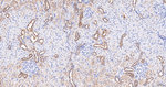 gamma Adaptin Antibody in Immunohistochemistry (Paraffin) (IHC (P))