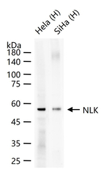 NLK Antibody in Western Blot (WB)