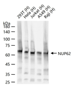 NUP62 Antibody in Western Blot (WB)