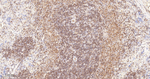 PAG1 Antibody in Immunohistochemistry (Paraffin) (IHC (P))