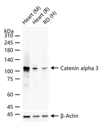 CTNNA3 Antibody in Western Blot (WB)