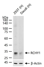 Pirh2 Recombinant Rabbit Monoclonal Antibody (6C7)