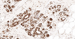 CIRBP Antibody in Immunohistochemistry (Paraffin) (IHC (P))