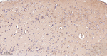 ACSL4 Antibody in Immunohistochemistry (Paraffin) (IHC (P))