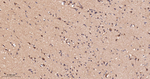 ACSL4 Antibody in Immunohistochemistry (Paraffin) (IHC (P))