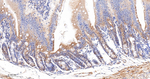ACSL4 Antibody in Immunohistochemistry (Paraffin) (IHC (P))