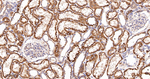 ACSL4 Antibody in Immunohistochemistry (Paraffin) (IHC (P))