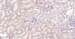 ACSL4 Antibody in Immunohistochemistry (Paraffin) (IHC (P))