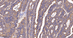 FADS1 Antibody in Immunohistochemistry (Paraffin) (IHC (P))