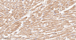 FADS1 Antibody in Immunohistochemistry (Paraffin) (IHC (P))