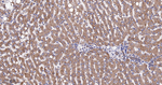 FADS1 Antibody in Immunohistochemistry (Paraffin) (IHC (P))