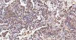 FADS1 Antibody in Immunohistochemistry (Paraffin) (IHC (P))