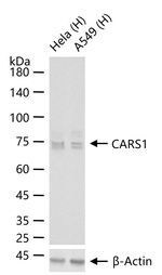 CARS Antibody in Western Blot (WB)