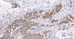 SERPINB3 Antibody in Immunohistochemistry (Paraffin) (IHC (P))