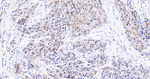 SERPINB3 Recombinant Rabbit Monoclonal Antibody (4A1)