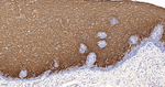 SERPINB3 Antibody in Immunohistochemistry (Paraffin) (IHC (P))