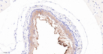 SERPINB3 Antibody in Immunohistochemistry (Paraffin) (IHC (P))
