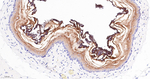 SERPINB3 Antibody in Immunohistochemistry (Paraffin) (IHC (P))