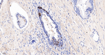 SERPINB3 Antibody in Immunohistochemistry (Paraffin) (IHC (P))