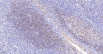 SERPINB3 Antibody in Immunohistochemistry (Paraffin) (IHC (P))