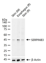 SERPINB3 Antibody in Western Blot (WB)