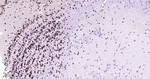 CtBP2 Antibody in Immunohistochemistry (Paraffin) (IHC (P))