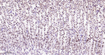 CtBP2 Antibody in Immunohistochemistry (Paraffin) (IHC (P))