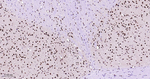 CtBP2 Antibody in Immunohistochemistry (Paraffin) (IHC (P))