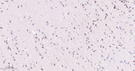 CtBP2 Antibody in Immunohistochemistry (Paraffin) (IHC (P))