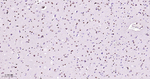 CtBP2 Antibody in Immunohistochemistry (Paraffin) (IHC (P))