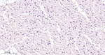 CtBP2 Antibody in Immunohistochemistry (Paraffin) (IHC (P))