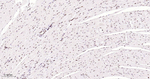 CtBP2 Antibody in Immunohistochemistry (Paraffin) (IHC (P))