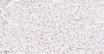 CtBP2 Antibody in Immunohistochemistry (Paraffin) (IHC (P))