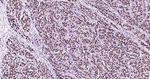 CtBP2 Antibody in Immunohistochemistry (Paraffin) (IHC (P))