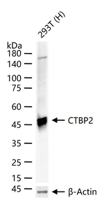 CtBP2 Antibody in Western Blot (WB)