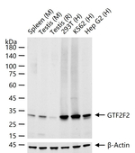 GTF2F2 Recombinant Rabbit Monoclonal Antibody (5F11)