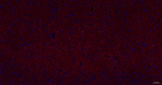 NCS1 Antibody in Immunohistochemistry (Paraffin) (IHC (P))