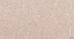 NCS1 Antibody in Immunohistochemistry (Paraffin) (IHC (P))