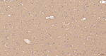 NCS1 Antibody in Immunohistochemistry (Paraffin) (IHC (P))
