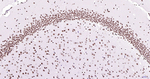 H3K28ac Antibody in Immunohistochemistry (Paraffin) (IHC (P))