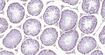H3K28ac Antibody in Immunohistochemistry (Paraffin) (IHC (P))