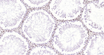 H3K28ac Antibody in Immunohistochemistry (Paraffin) (IHC (P))